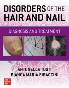 Disorders of the Hair and Nail "Diagnosis and Treatment"