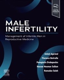 Male Infertility "Management Infertile Men Reproductive"