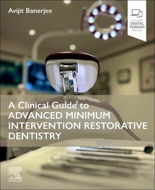 A Clinical Guide to Advanced Minimum Intervention Restorative Dentistry