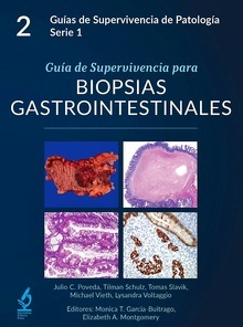 Guía de Supervivencia para Biopsias Gastrointestinales