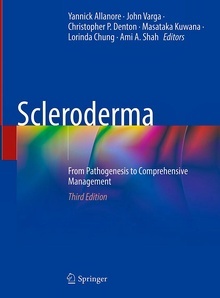 Scleroderma "From Pathogenesis to Comprehensive Management"
