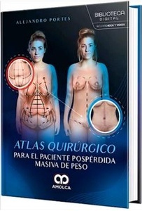 Atlas Quirúrgico para el Paciente Pospérdida Masiva de Peso