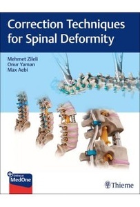 Correction Techniques For Spinal Deformity