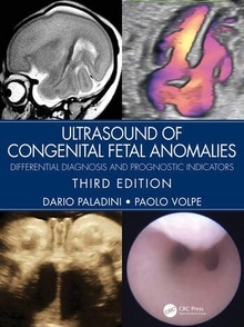 Ultrasound of Congenital Fetal Anomalies "Differential Diagnosis and Prognostic Indicators"