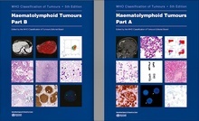 WHO Classification of Tumours: Haematolymphoid Tumours. Part A and Part B 2 Vols. Vol.10