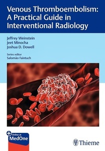 Venous Thromboembolism "A Practical Guide in Interventional Radiology"