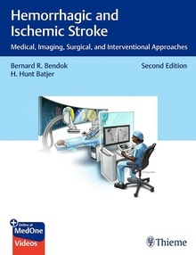 Hemorrhagic and Ischemic Stroke "Medical, Imaging, Surgical, and Interventional Approaches"