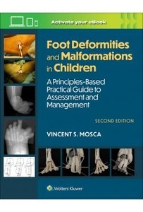 Foot Deformities And Malformations In Children "A Principles-Based  Practical Guide To Assessment And Management"