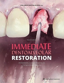 Immediate Dentoalveolar Restoration "Immediately Loaded Implants in Compromised Sockets"