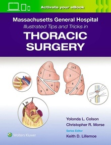 Illustrated Tips and Tricks in Thoracic Surgery "MASSACHUSETTS GENERAL HOSPITAL"