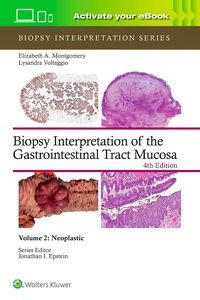 Biopsy Interpretation Of The Gastrointestinal Tract Mucosa Vol. 2 "Neoplastic"