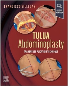 Tulua Abdominoplasty "Transverse Plication Technique"