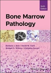 Bone Marrow Pathology