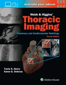 WEBB & HIGGINS Thoracic Imaging "Pulmonary and Cardiovascular Radiology"